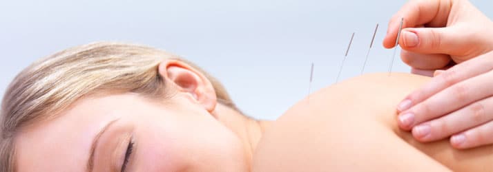 Chiropractic Lakewood CO Dry Needling Chiropractic Lakewood CO Dry Needling